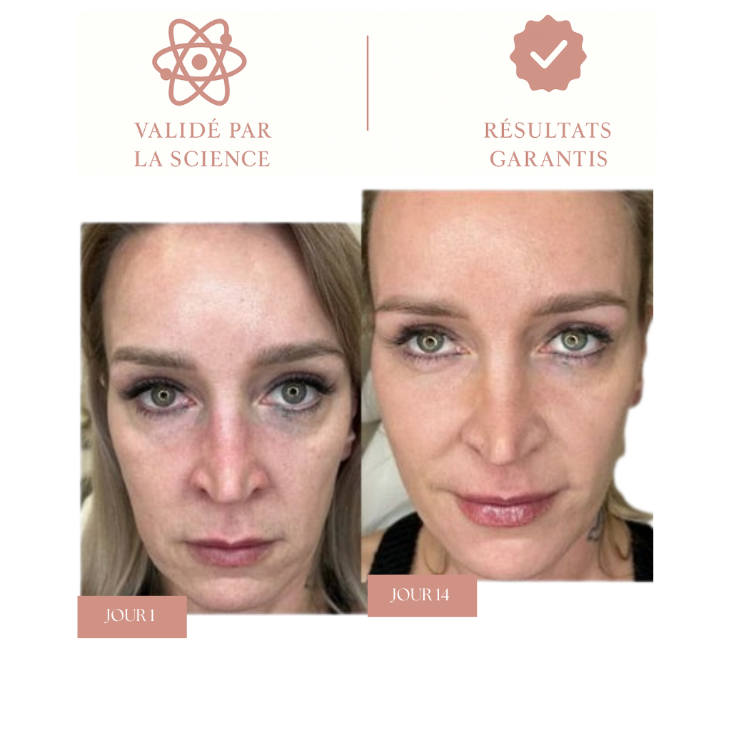 Masque Collagène