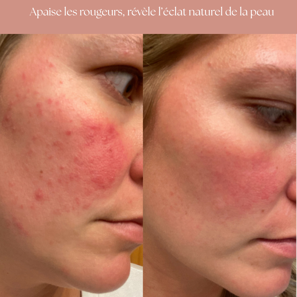 Masque Collagène